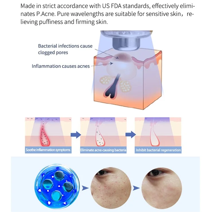 CM-5-RF Radio Frequency Skin Tightening Firming Machine Microcurrent Facial Device Wrinkles Facial Toning Tool - White