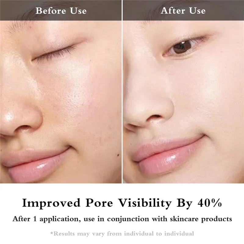 2405 EMS Microcurrent Eye Beauty Device with Hot Compress LED Vibration Eye Skin Care Wand - Black