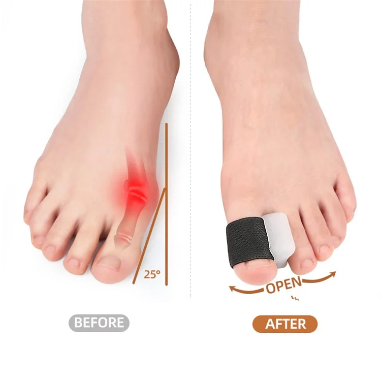 114 Zehentrenner Größe L / Paar Hallux Valgus Korrektur Zehenspreizer Gel-Kissen zur Schmerzlinderung Komfortables Tragen - Schwarz