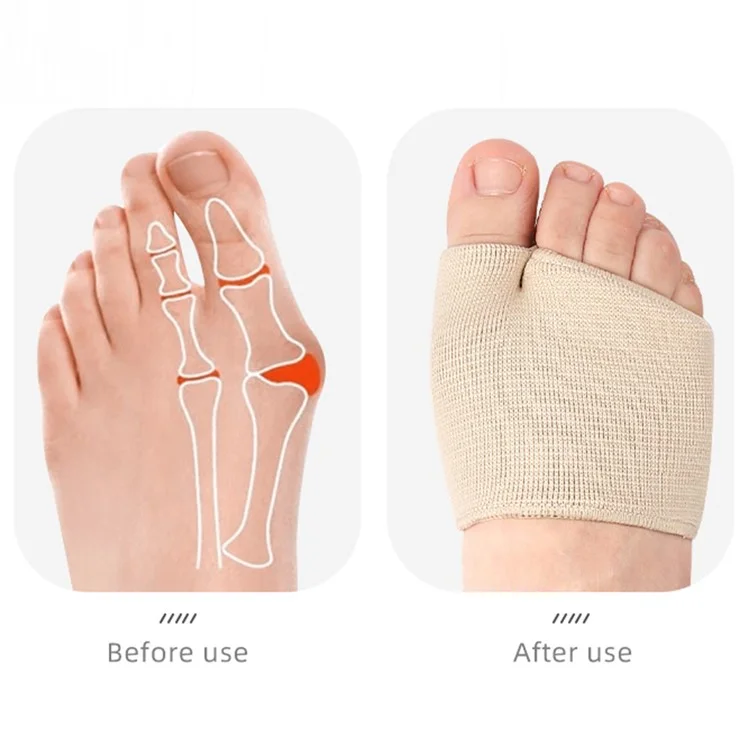 1 Paar S Größe Hallux Valgus Entlastungsmanschette Metatarsales Gel-Kissen Korrektur Schräg Genähter Fußschutz - Schwarz