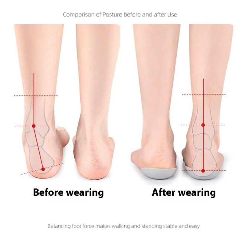 039 1 Pair Size L Magnetic Arch Support Insoles Half Length TPR Shock Absorbing Orthotic Insert Pad - Grey