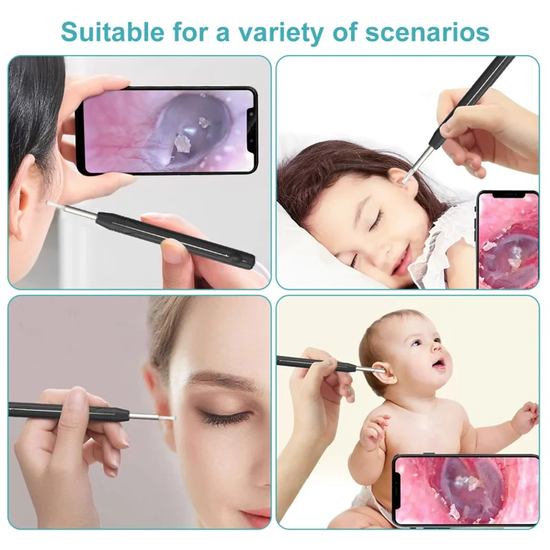 W1 Ear Wax Removal Tool Camera WiFi Ear Cleaning Kit Ear Pick with LED Light - Green