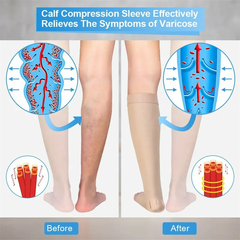 Size M 20-30mmHg Compression Calf Sleeve Breathable Open Toe Stockings for Varicose Veins, Skin Color