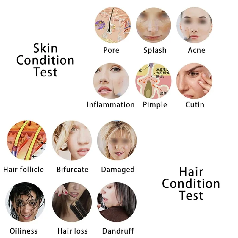 5 Inch Scalp Detector Digital Skin Analyzer Live Image Skin Microscope with 50X  /  200X Magnification Lens - US Plug