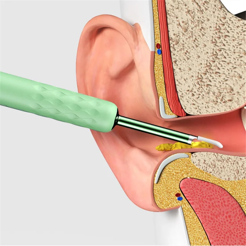 BEBIRD R3 Rechargeable WiFi Endoscope Ear Cleaner Wireless Otoscope Camera Ear Picker Cleaning Tool - White