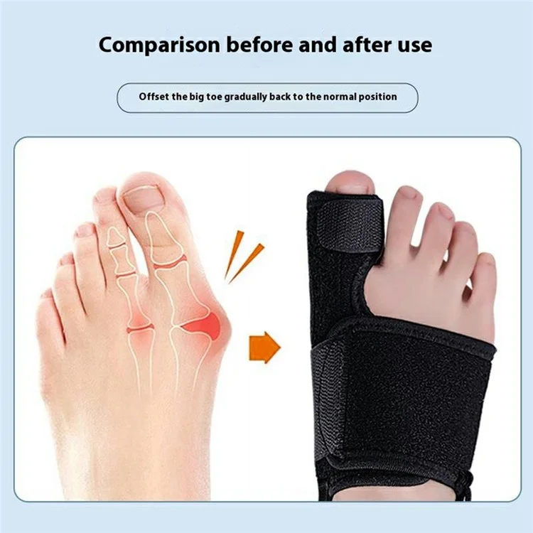 003 Bunion Korrektur Verstellbarer Zehentrenner Orthopädische Einlage Knochenkorrektur Daumen Verstellgerät Fußpflegewerkzeug - Schwarz / Rechts
