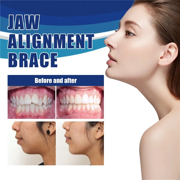 EELHOE EEA08-A105-1-MX1 Jaw Alignment Brace Orthodontic Appliance for Teeth Straightening Overbite Correction