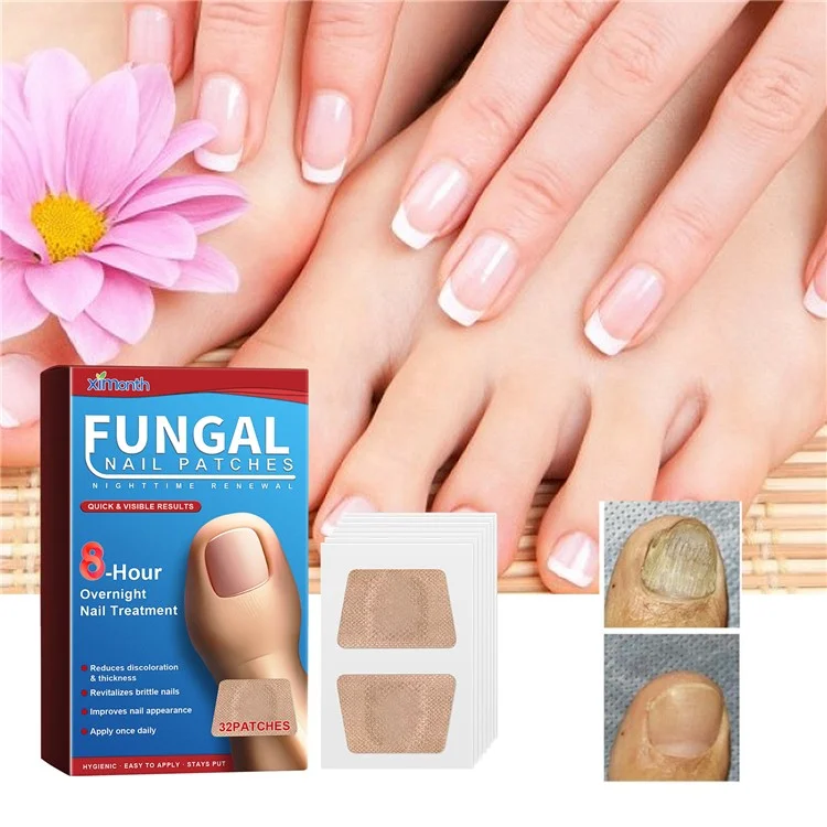 XIMONTH XIB05-A006-32-BU1 32Pcs Fungal Nail Patches Ingrown Toenail Overnight Repair Treatment