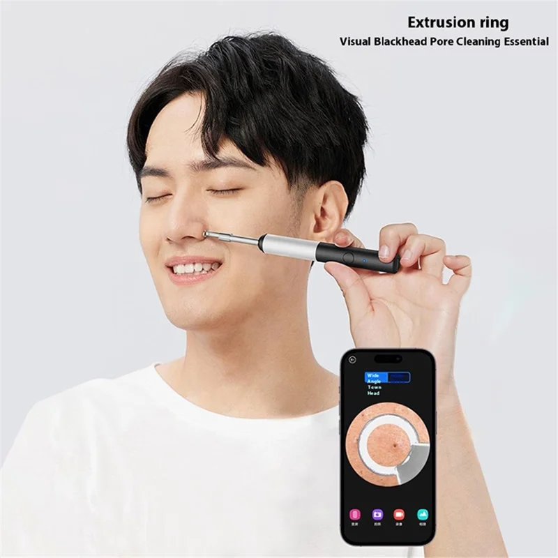 P80 High Definition 1920P Wireless Smart Ear Cleaning Endoscope Ear Wax Removal Tool Kit, Standard Version - White