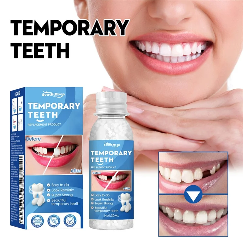 SOUTH MOON 30ml Perles Thermomoulables de Réparation Dentaire Temporaires pour Fausses Dents, Adhésif Dentaire Malléable, SOA07-A005-30-BU1