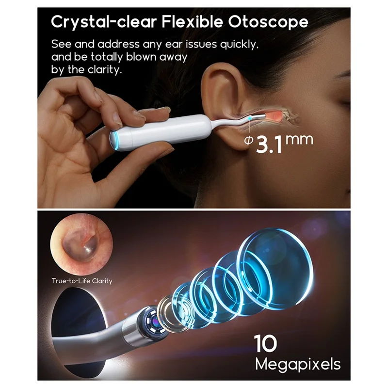 BEBIRD Home 30S 4 in 1 Smart Visual Ear Cleaner Ear Wax Removal Stick HD Endoscope Earpick