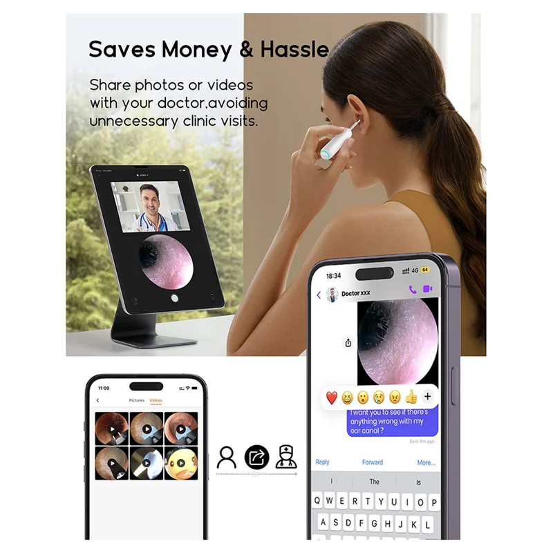 BEBIRD Home 30S 4 in 1 Smart Visual Ear Cleaner Ear Wax Removal Stick HD Endoscope Earpick