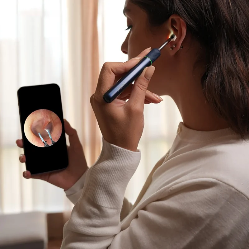BEBIRD Note5 Intelligenter visueller Ohrstöpsel mit 10-MP-Kamera Endoskop-Pinzette Gesundheitspflege Ohreiniger