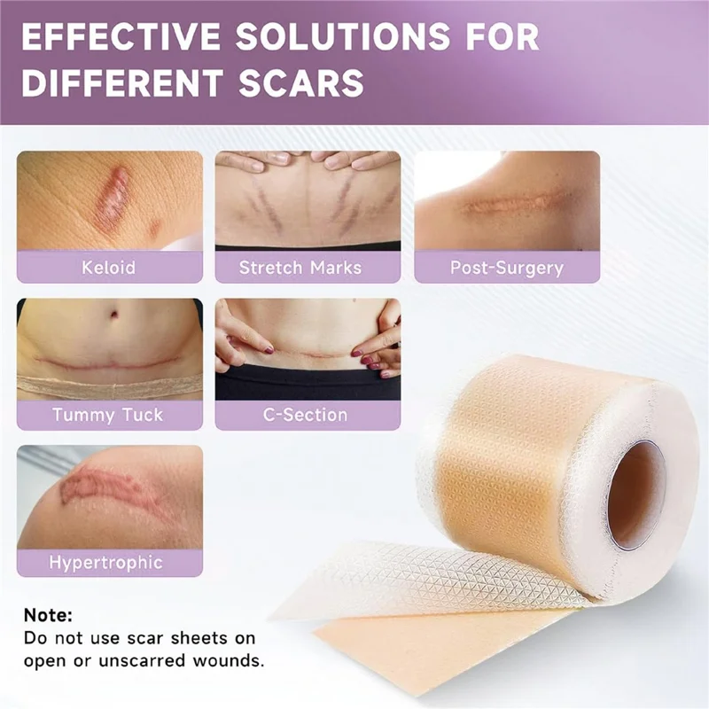 1.5m Length Silicone Scar Removal Sheet Self Adhesive Waterproof Scar Coverage Tape for Skin Repair, 4cm Width