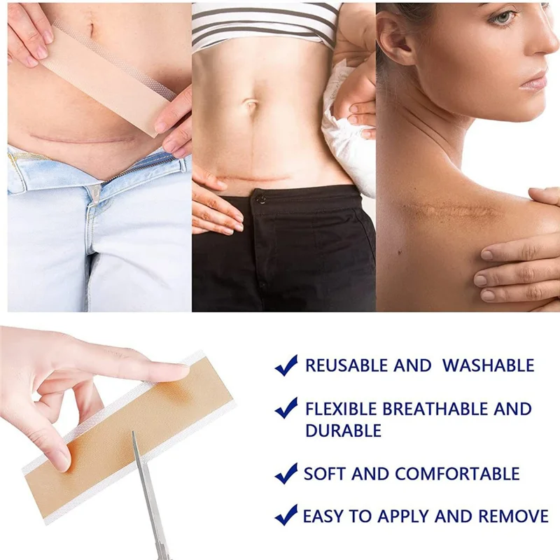 3m Length Silicone Scar Removal Sheet Self Adhesive Waterproof Scar Coverage Tape for Skin Repair, 4cm Width
