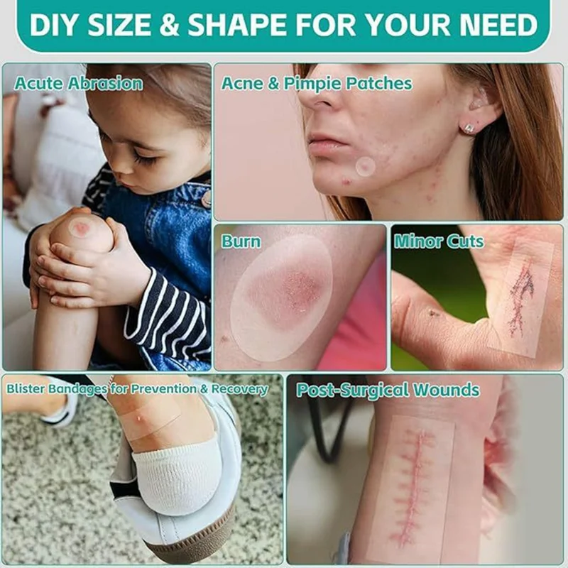 3.6m Length Hydrocolloid Wound Dressing Roll Medical Grade Absorbent Bandage for Wound Care, 5cm Width