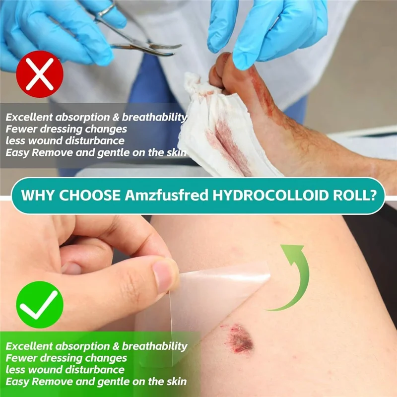 3.6m Length Hydrocolloid Wound Dressing Roll Medical Grade Absorbent Bandage for Wound Care, 5cm Width