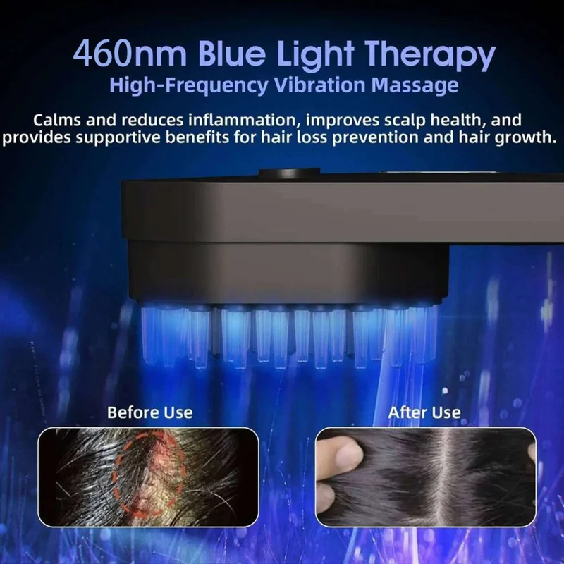 Peigne de massage électrique du cuir chevelu CS-01X, soin des cheveux avec lumière rouge intelligente et technologie de microcourant EMS - Noir