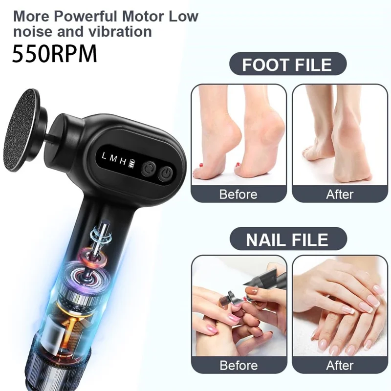C2 Electric Foot Callus Remover 2 in 1 Portable Pedicure Tool Dead Skin Remover Nail File 6 Speed Adjustable - Black