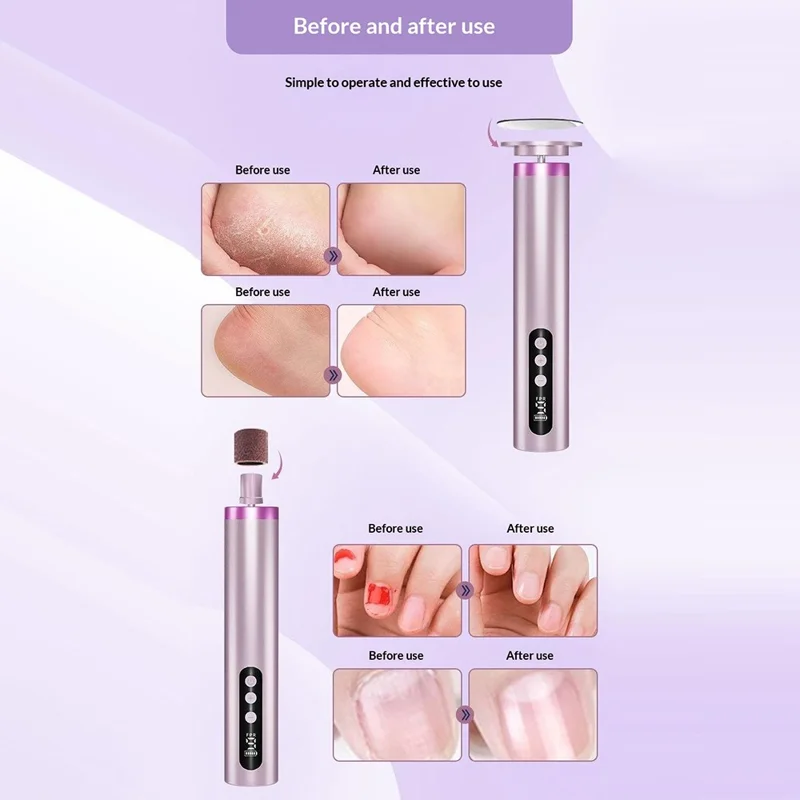 GMC-253 Electric Foot Callus Remover Rechargeable Dead Skin Corn Removal 2 in 1 Foot Care Device - Grey