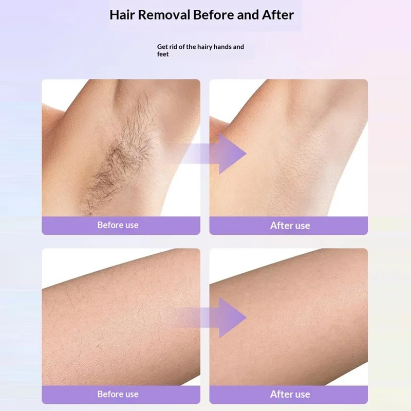 HX-106 Women's Facial Hair Remover Electric Multi-Function Hair Removal Exfoliation Device - Pink