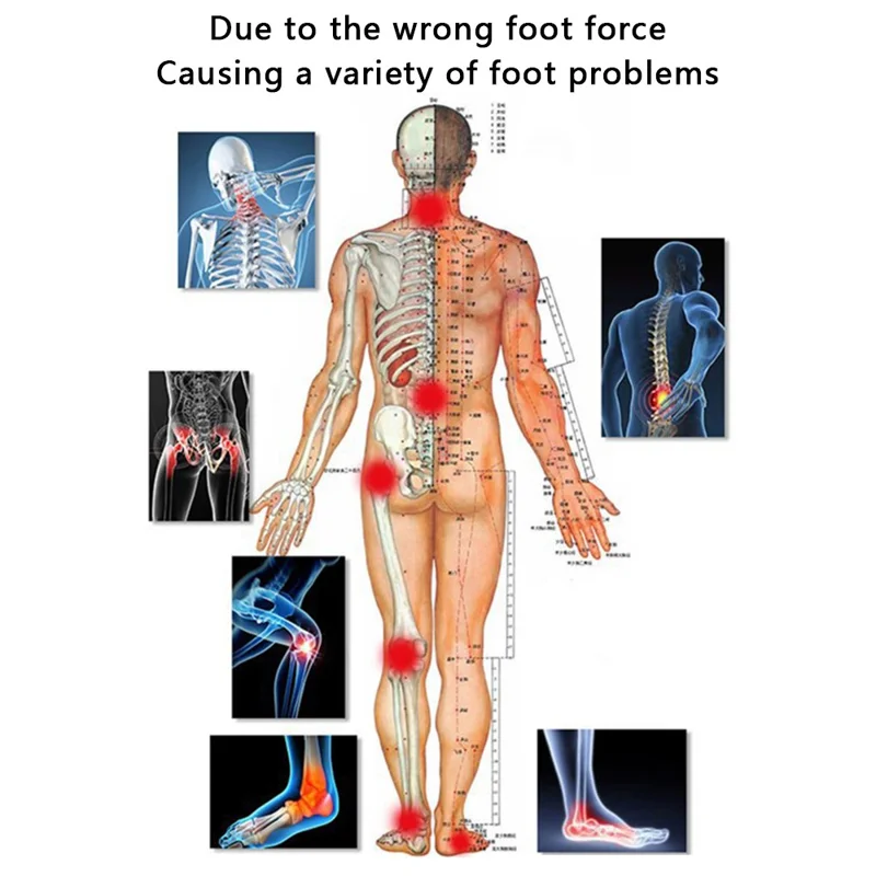 1 Pair TPR Flat Foot O-Shaped Legs Insole Arch Support Plantar Fasciitis Shoe Inserts - Black / Size S (35-39)