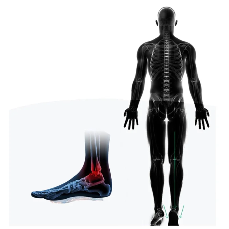 1 Pair Silicone Arch Support Insole Gel Pads Flat Foot Support Adhesive High Heel Inserts Pain Relief - S