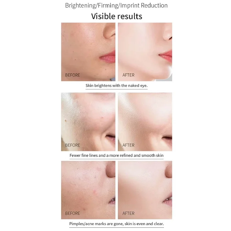 7-Color Photon Spectrum LED Face Mask for Skin Rejuvenation Light Therapy Beauty Device Gift - Black