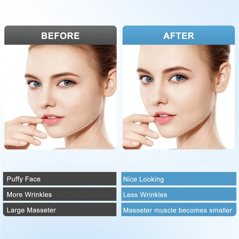 Microcurrent V-Face Slimming Instrument 6 Modes Red Blue Light Therapy Skin Rejuvenation Device