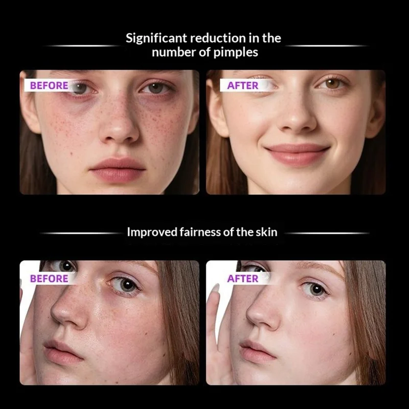 SP-1103F Magnetic Wireless Silicone LED Light Therapy Face Mask 7 Colors Photon Beauty Device