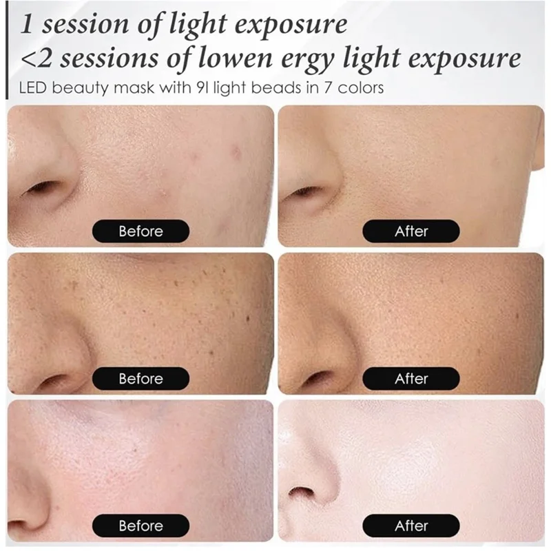 SP-1103A 7 Color LED Light Therapy Face Mask Silicone 93 LED Beads Photon Skin Care for Anti-Aging