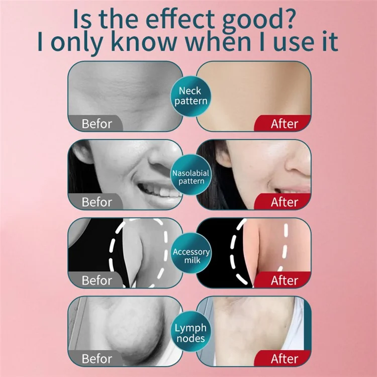 HWQ014 Household Electronic Gua Sha Facial Massager Portable Skin Scraping Device for Eye / Face / Wrinkles - Pink