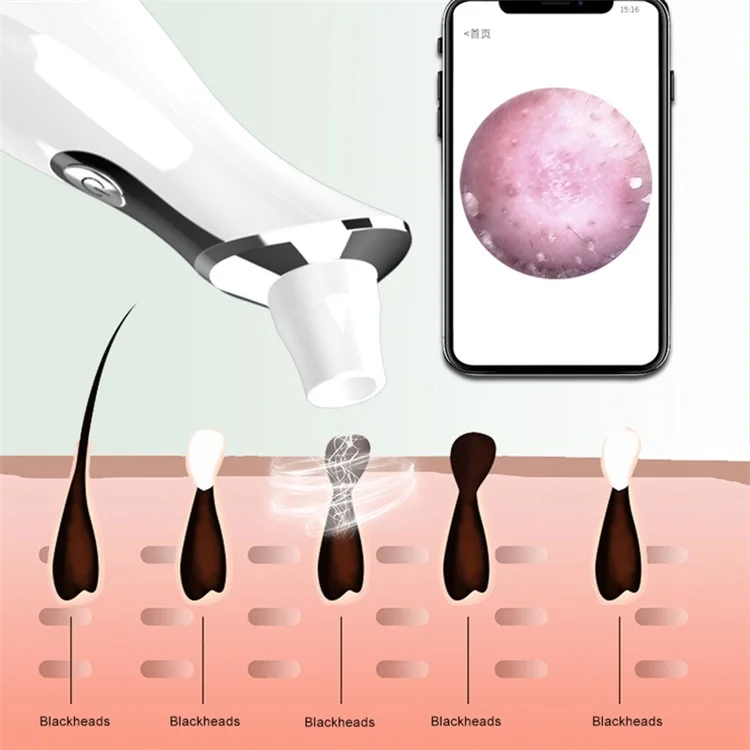 DYM-028 WiFi Phone App Monitoring Blackhead Remover Pore Cleaner Acne Blackhead Suction Extractor