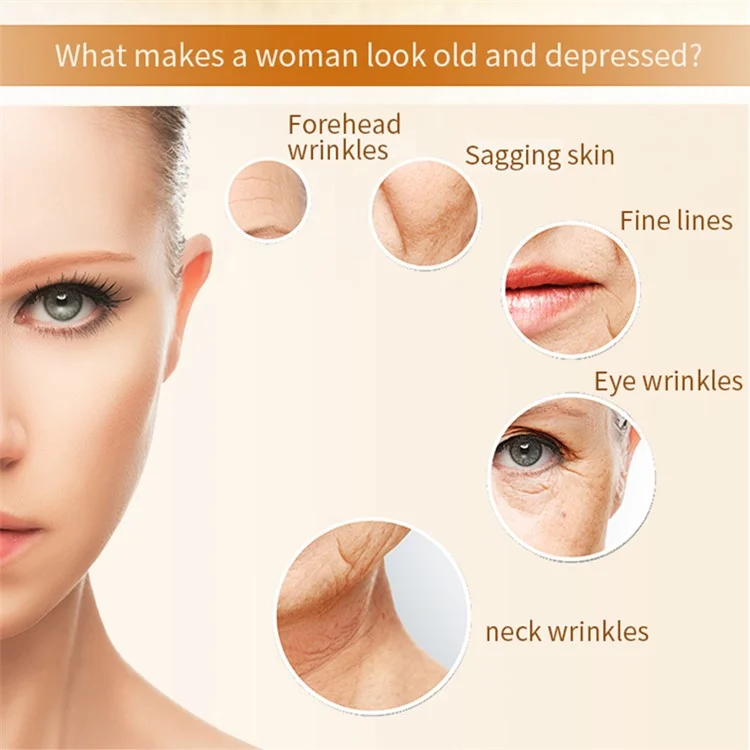 Máquina de radiofrecuencia para el apretado y el firming de la piel CM-5-RF - Dispositivo facial microcorriente para arrugas, en color oro rosa