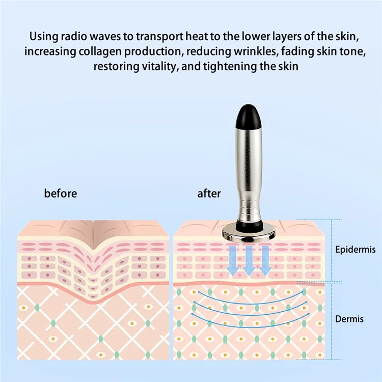 Máquina de radiofrecuencia facial para el levantamiento y remodelado corporal con tecnología bipolar de RF y EMS, con certificación CE (ST) - Enchufe europeo