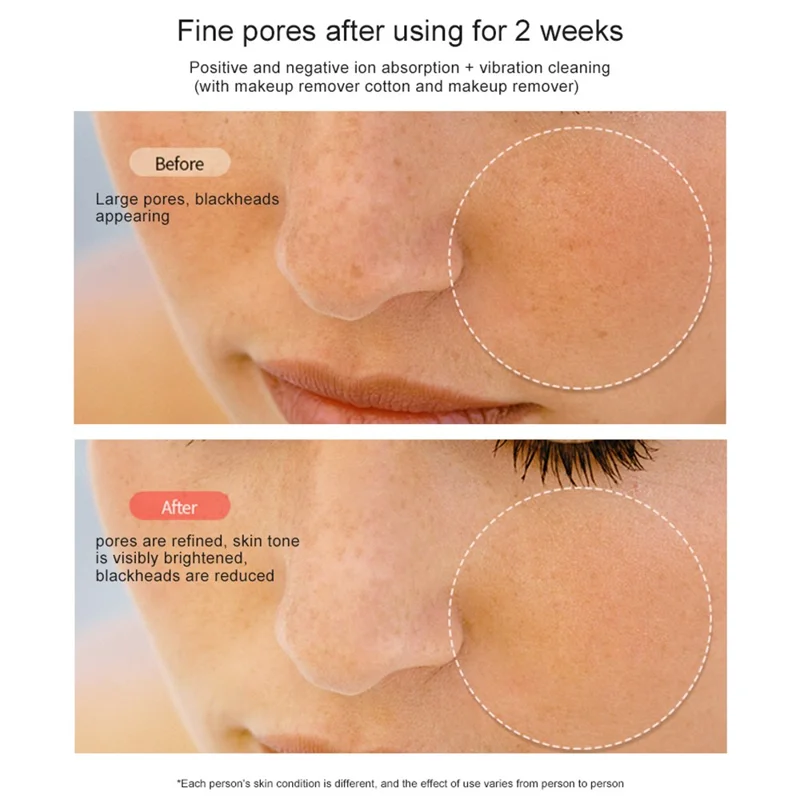 RF Ansigtsløftningsmaskine EMS Pulse Terapienhed Hudfornyelses Mikrostrøm Rynkefjerner - Sølv Hvid