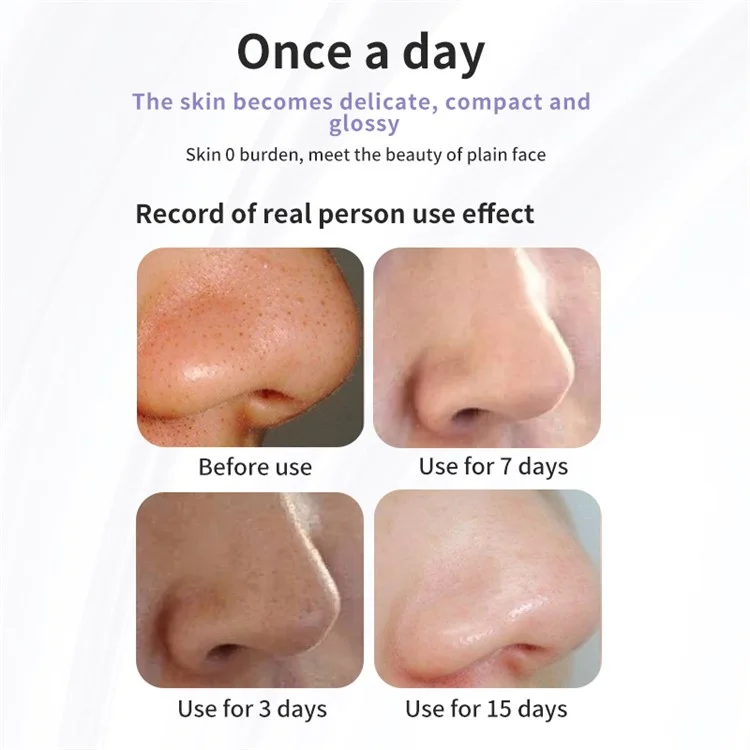 Pore Blackhead Rimodellamento Piccolo Bolle D'acqua Aspirazione Aspirazione Detergente Per il Viso Strumento di Estrattore di Whitehead Elettrico Per la Casa Attrezzatura di Bellezza