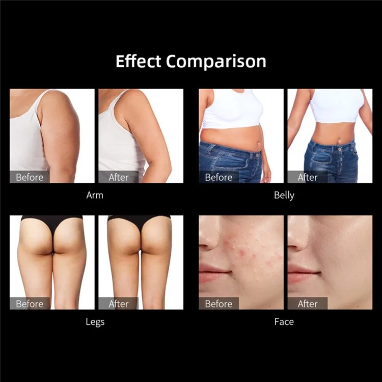 40K Cavitation Ultrasonic Weight Loss Beauty Machine RF Radio Frequency Skin Lifting Device, CE Certified (ST) - US Plug