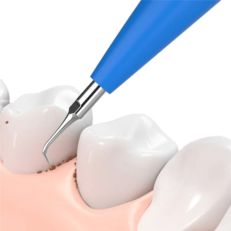 YJK099 Remover de Placa de de Dentes Bpa Remover de Dentes Elétrico Kit de Cullomento de Cullomento de Cullome - Azul
