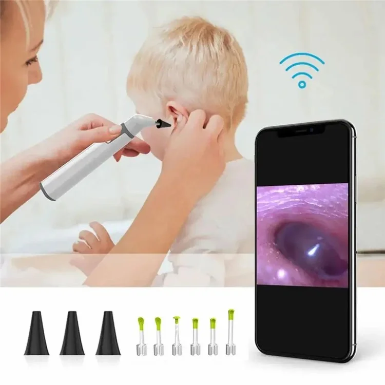 TESLONG SA39W Câmera Otoscópica Visual WiFi de 3,9 mm, Endoscópio para Ouvido, Limpador de Cera de Ouvido