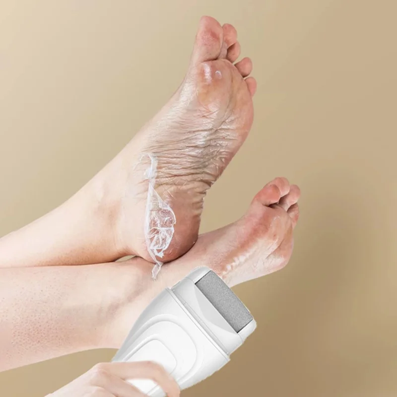 V-618 Electric Foot Callus Remover with Digital Display Pedicure Tools Foot Care Kit - White