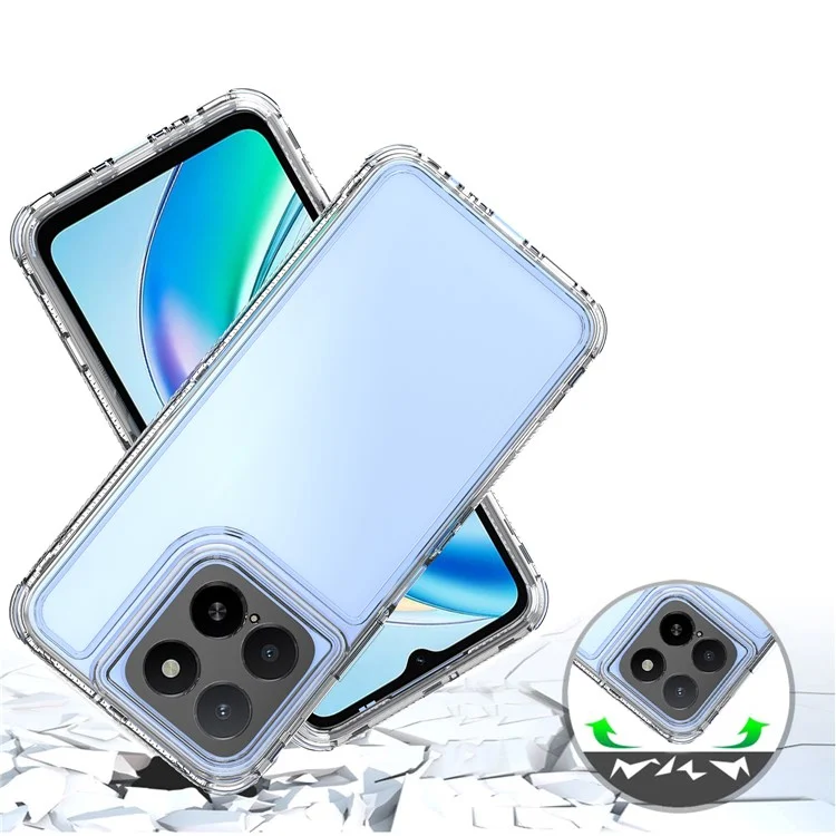 For Honor X5b Hülle Kratzfest Acryl TPU Transparente Handyhülle