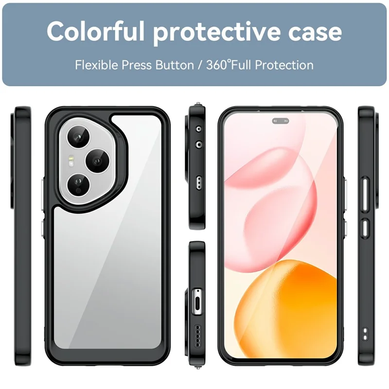 For Honor 400 Pro 5G (Global) Case TPU + Acrylic Protective Clear Phone Cover - Black