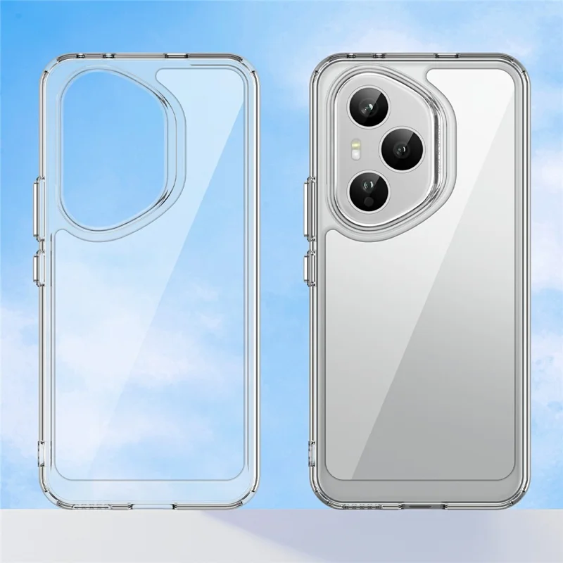 For Honor 400 Pro 5G (Global) Case TPU + Acrylic Protective Clear Phone Cover - Transparent