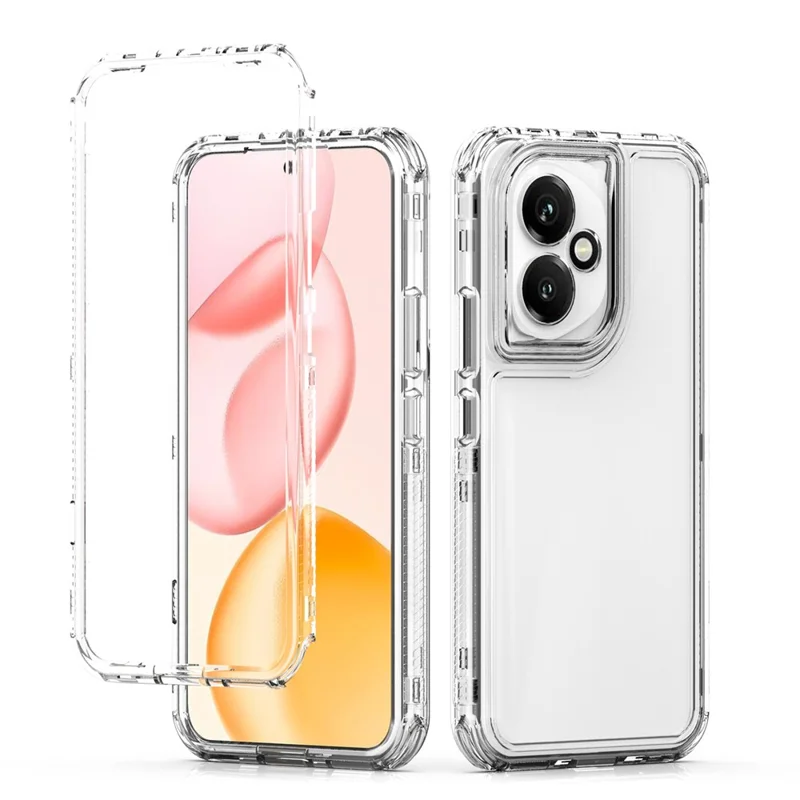 Funda de teléfono de cubierta de TPU acrílico antiarañazos para Honor 400 5G (Global)