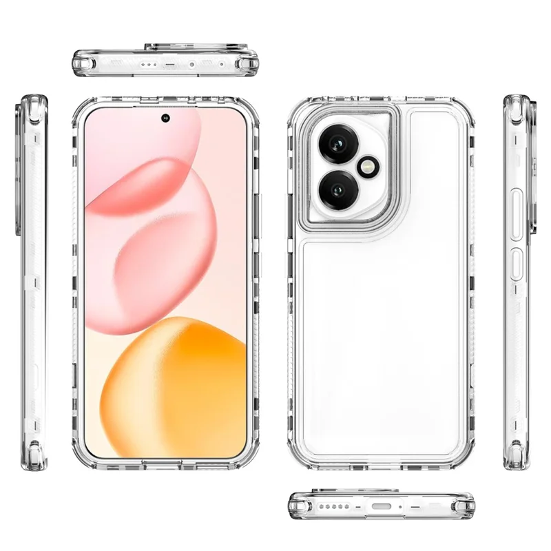Funda de teléfono de cubierta de TPU acrílico antiarañazos para Honor 400 5G (Global)