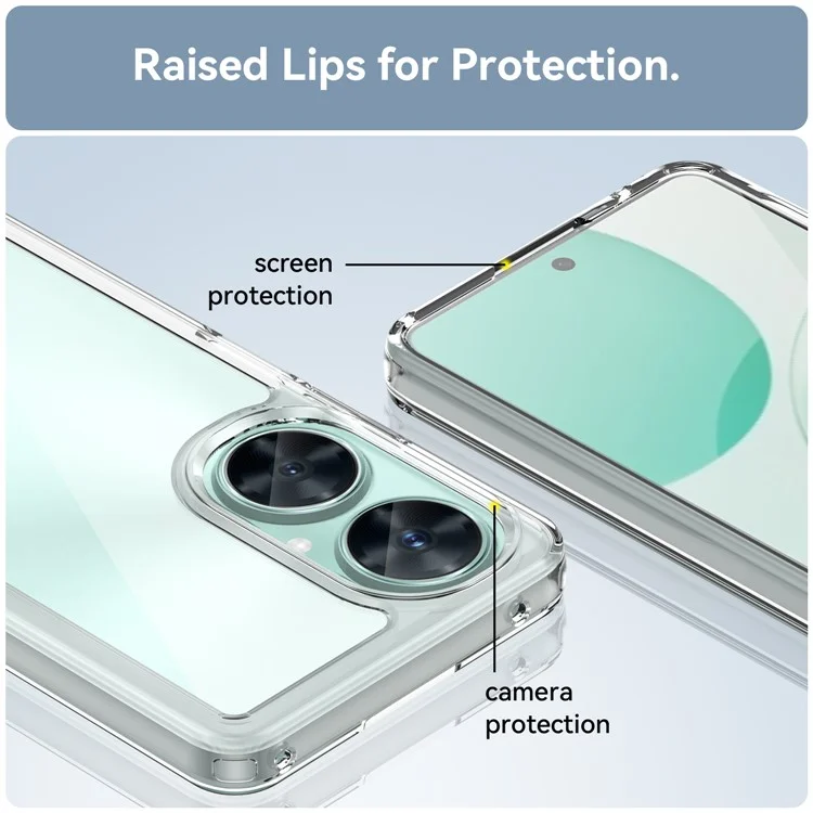 Capa Transparente para Huawei Maimang 20 com Botões Eletrodepositados (Orifício Grande para Lente Traseira)
