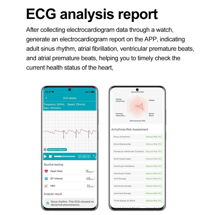 ET593 Orologio sportivo Bluetooth ECG con monitoraggio della temperatura corporale e della salute - Nero