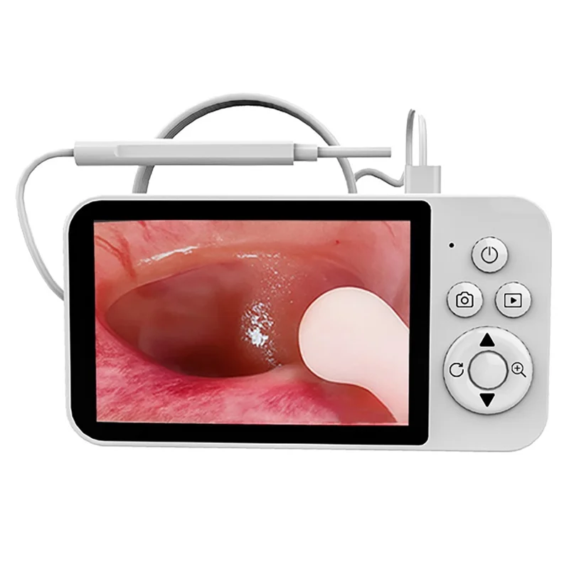 Y40 4.3 inch Screen Visual Otoscope Endoscope High Definition Visualization Ear Cleaning Endoscope