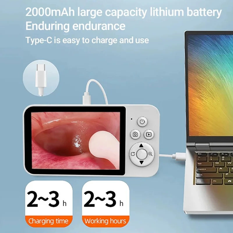 Y40 4.3 inch Screen Visual Otoscope Endoscope High Definition Visualization Ear Cleaning Endoscope